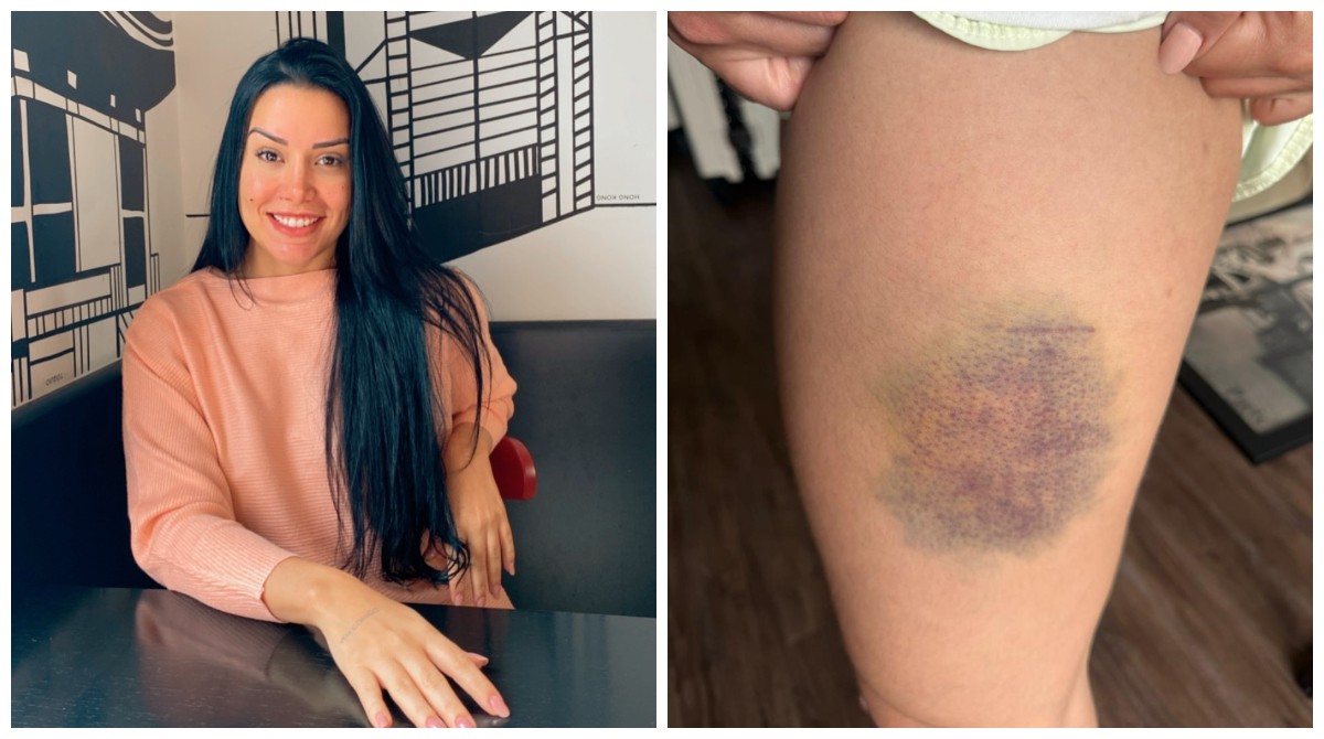 “Briguei pela vida”: nutricionista luta por 13 minutos contra invasor em Barueri