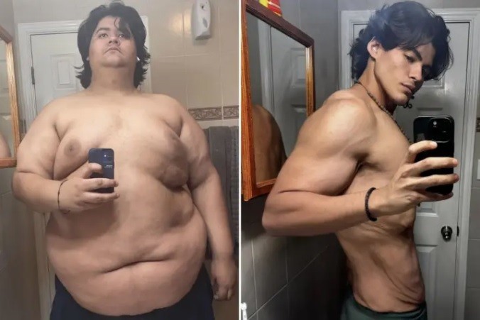Jovem perde 124 quilos sem cirurgia e vira coach de emagrecimento