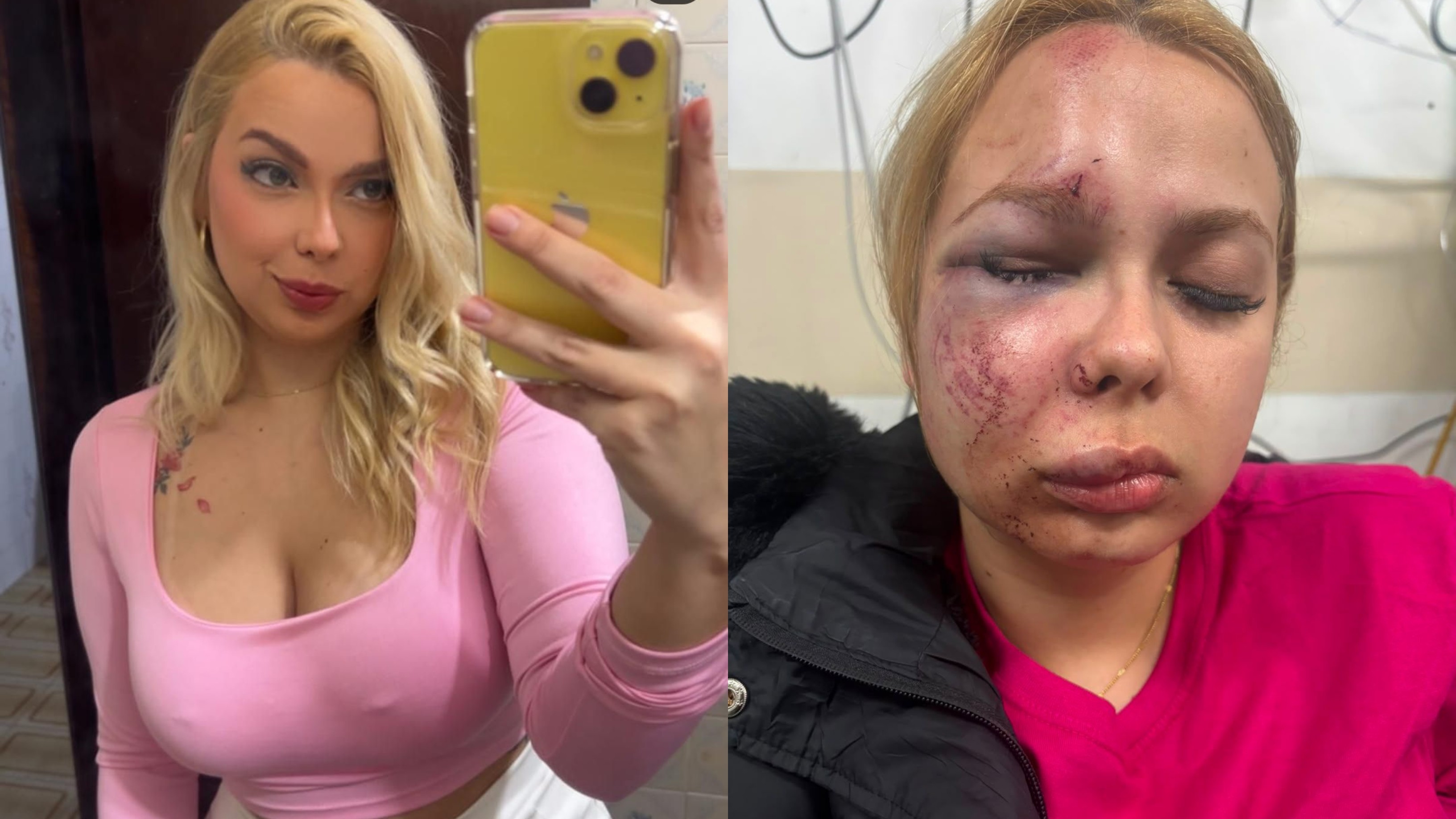 Mulher tem maxilar, joelho e nariz quebrados após agressão no Metrô de SP