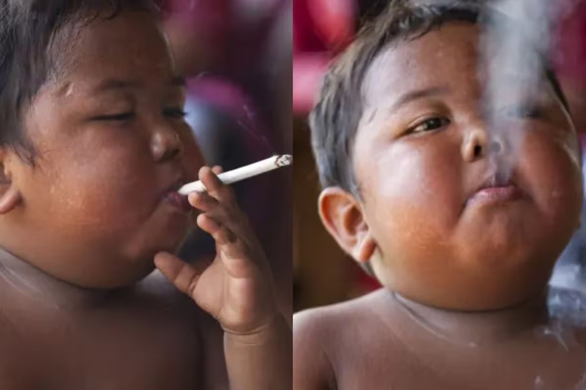 Menino que fumava 40 cigarros por dia aos 2 anos superou vício